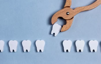 The Role of Tooth Extraction in Overall Oral Health